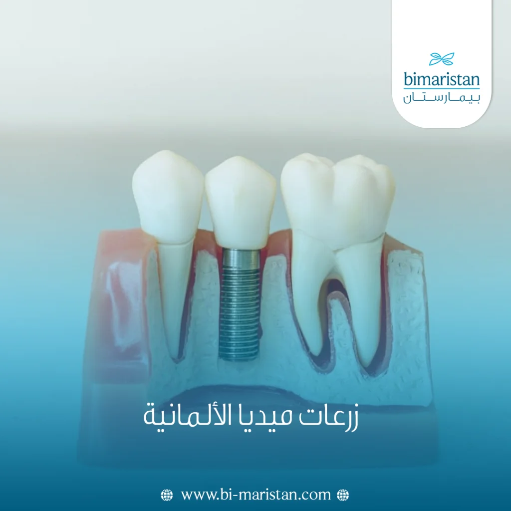 زرعات ميديا الألمانية: المميزات والتكلفة 2 زرعات ميديا الألمانية