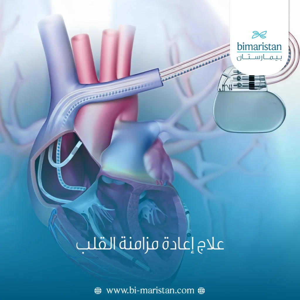 علاج إعادة مزامنة القلب