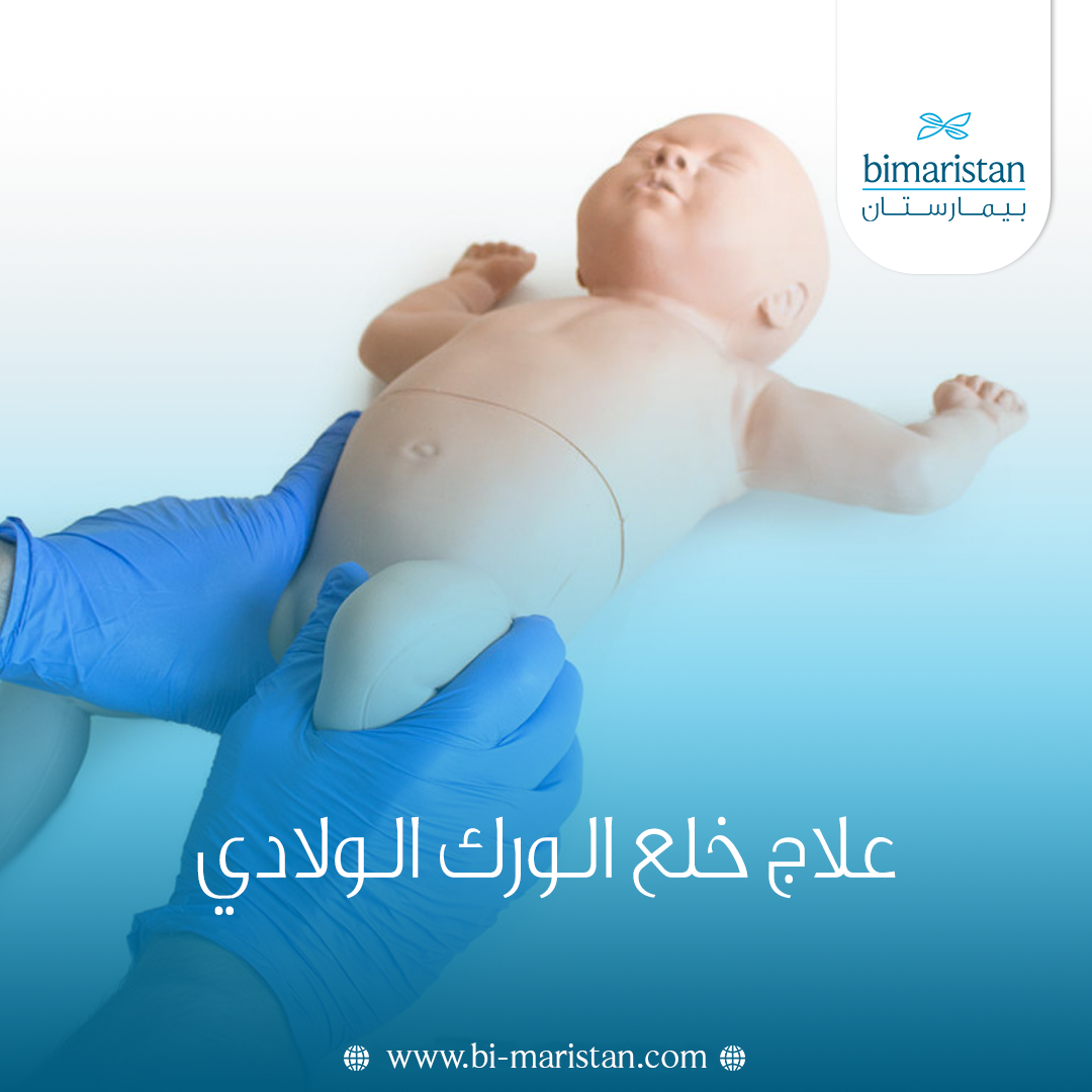 علاج خلع الورك الولادي