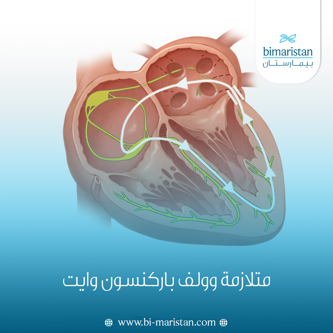 متلازمة وولف باركنسون وايت