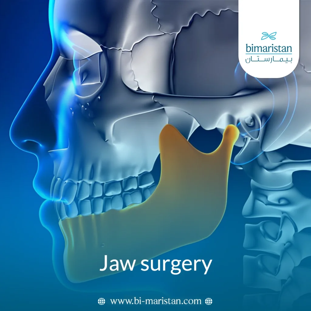 Jaw Surgery