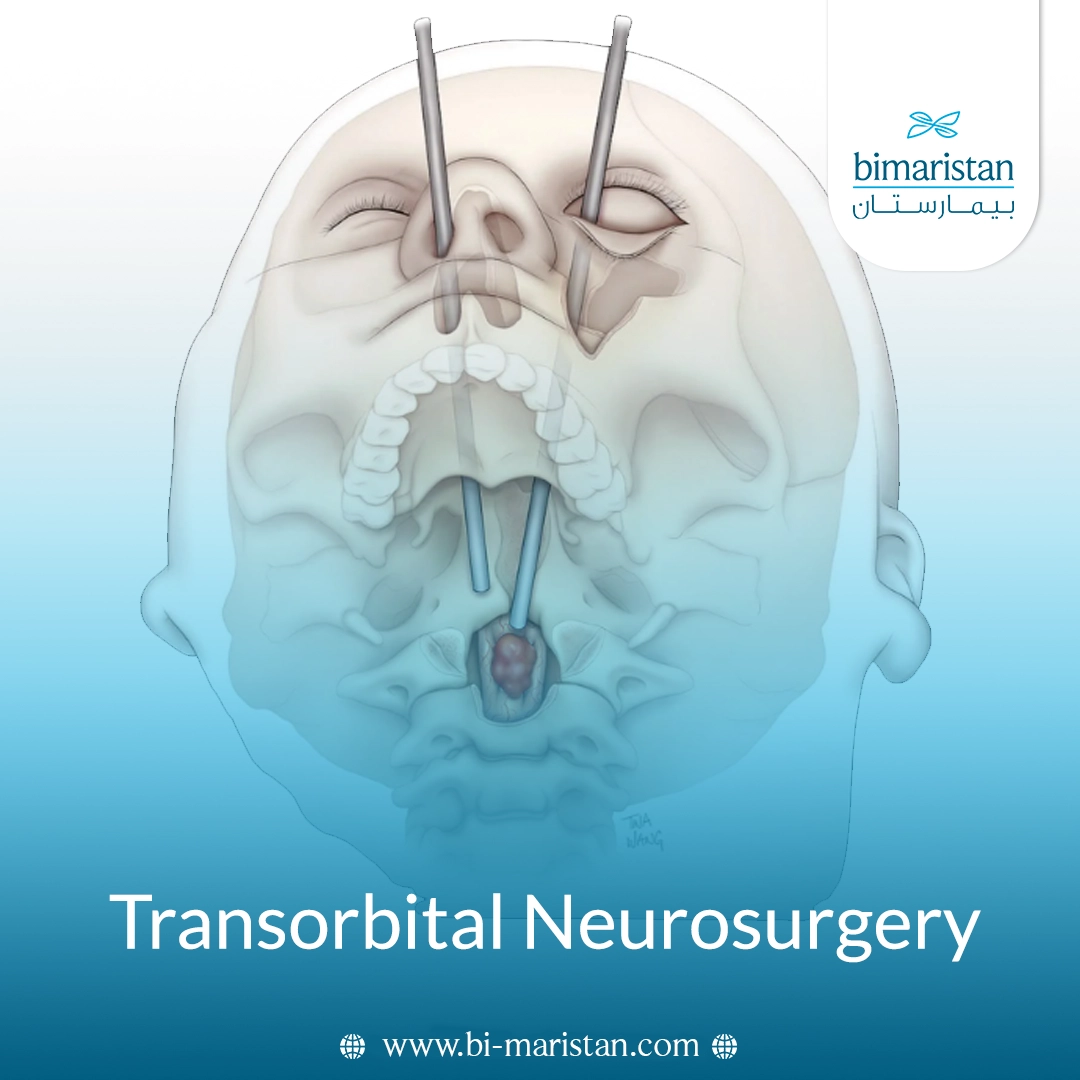 Transorbital Neurosurgery
