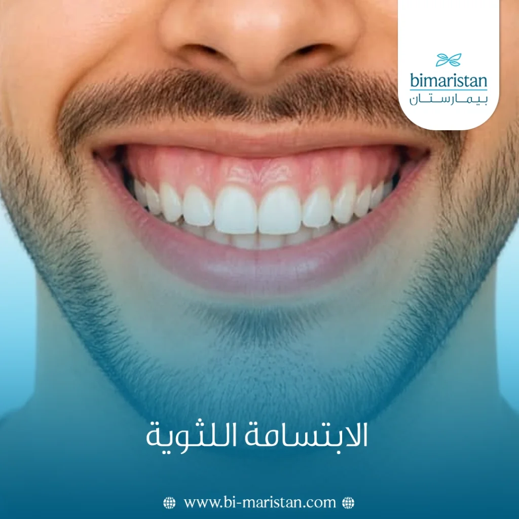الابتسامة اللثوية