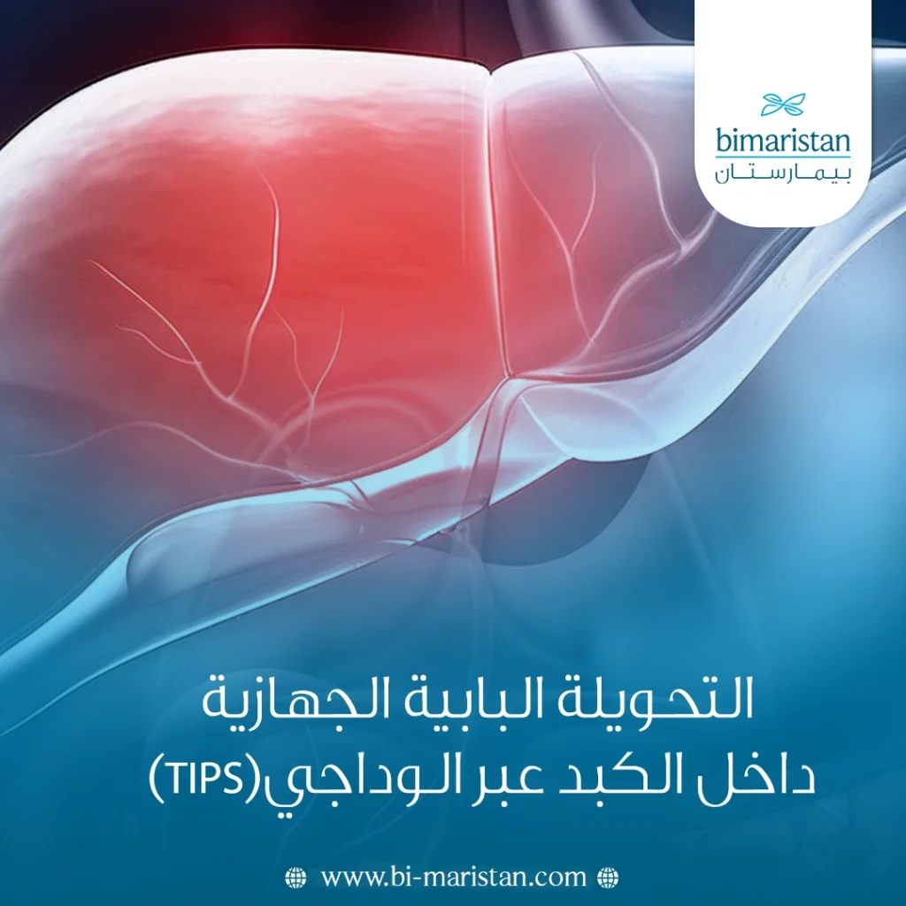 التحويلة البابية الجهازية داخل الكبد عبر الوداجي (Tips): دواعي الإجراء، وكيفية تنفيذه، وفوائده 1 لتحويلة البابية الجهازية داخل الكبد عبر الوداجي (Tips)