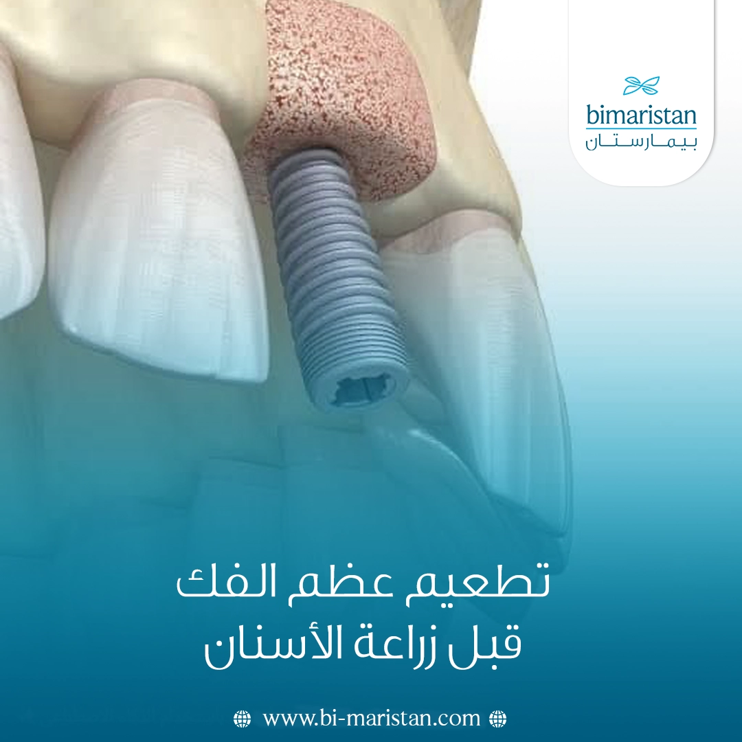 تطعيم عظم الفك