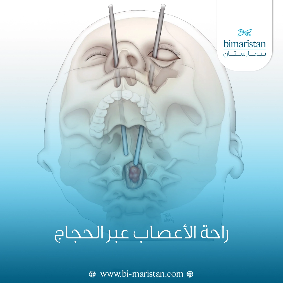 جراحة الأعصاب عبر الحجاج