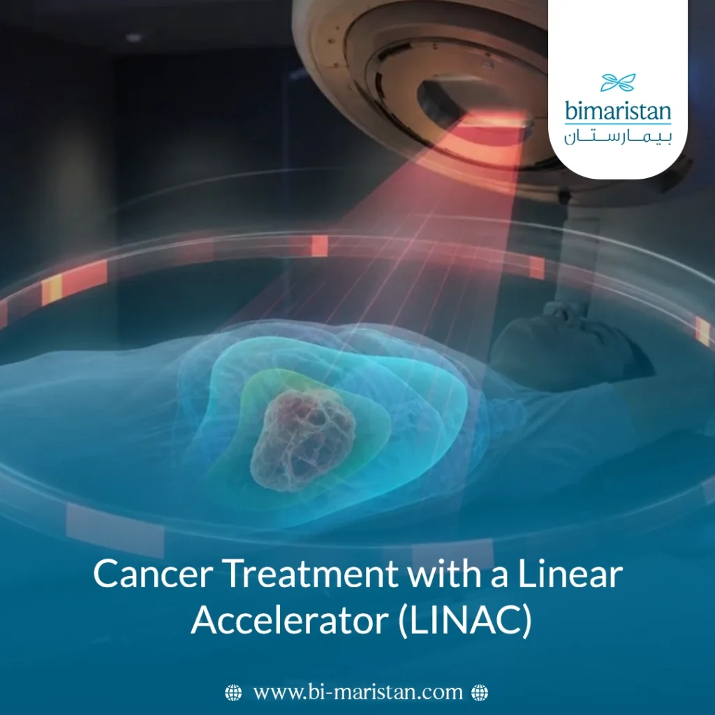 Cancer Treatment With Linear Accelerator (Linac)