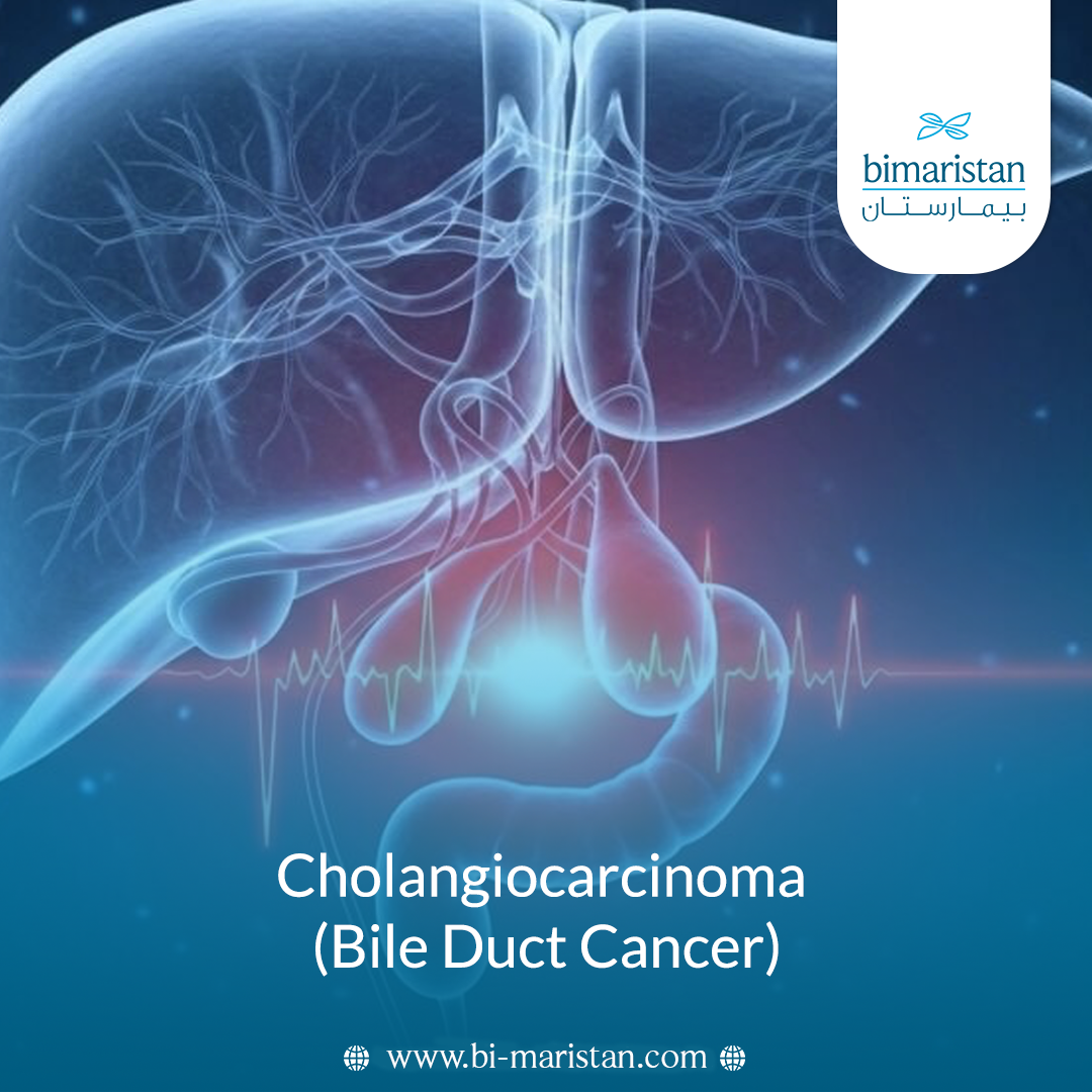 Cholangiocarcinoma (Bile Duct Cancer)