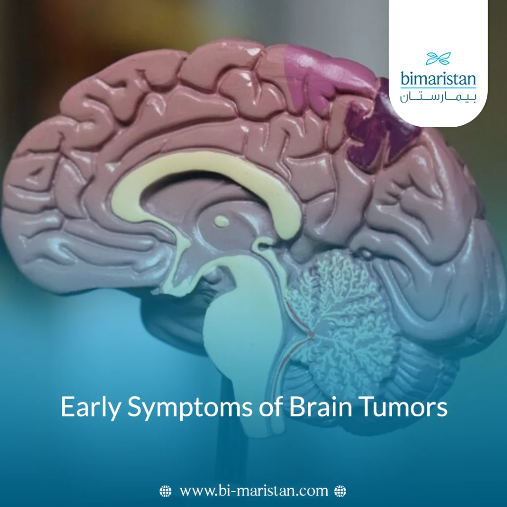 Early Symptoms Of Brain Tumors