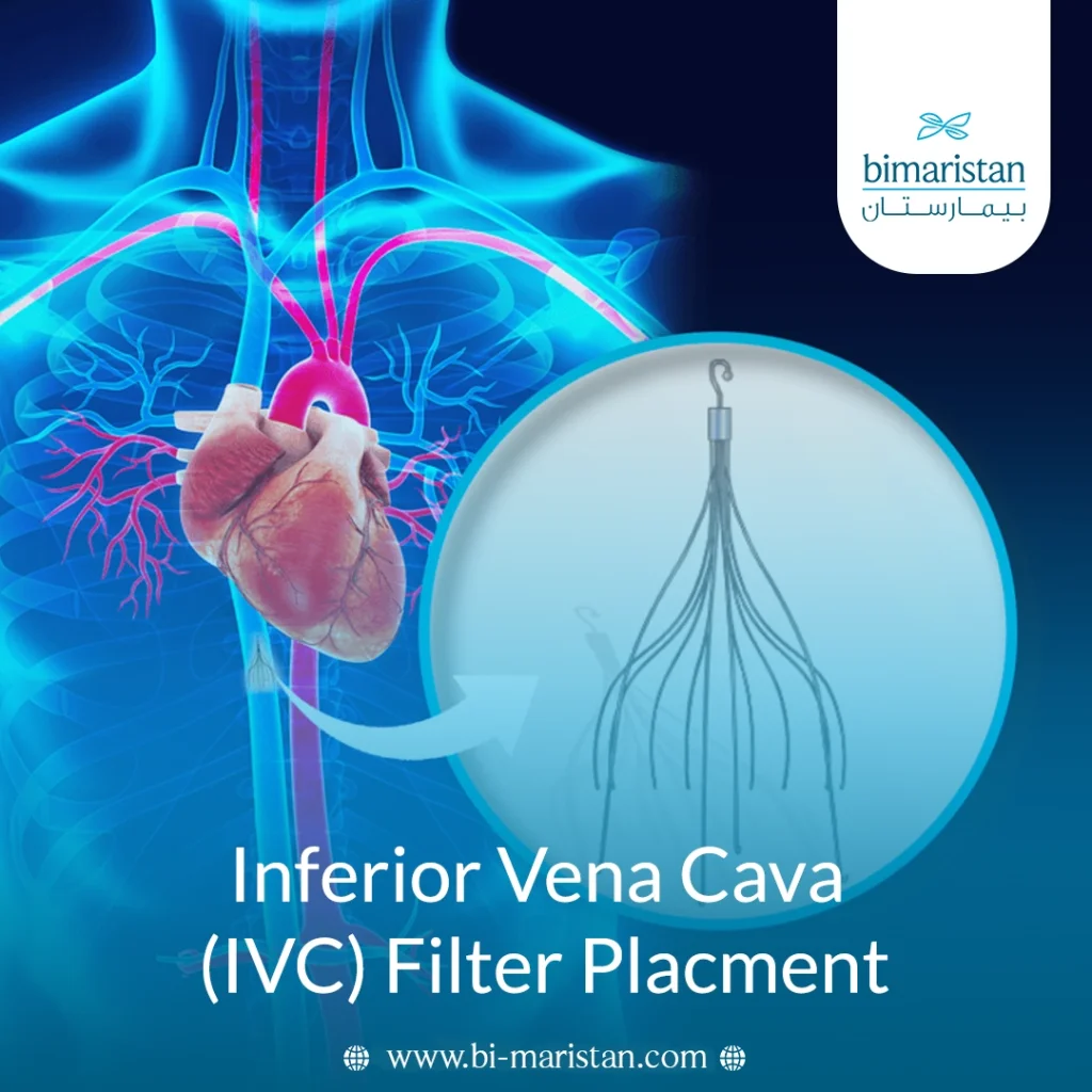 Inferior Vena Cava (Ivc) Filter Placment