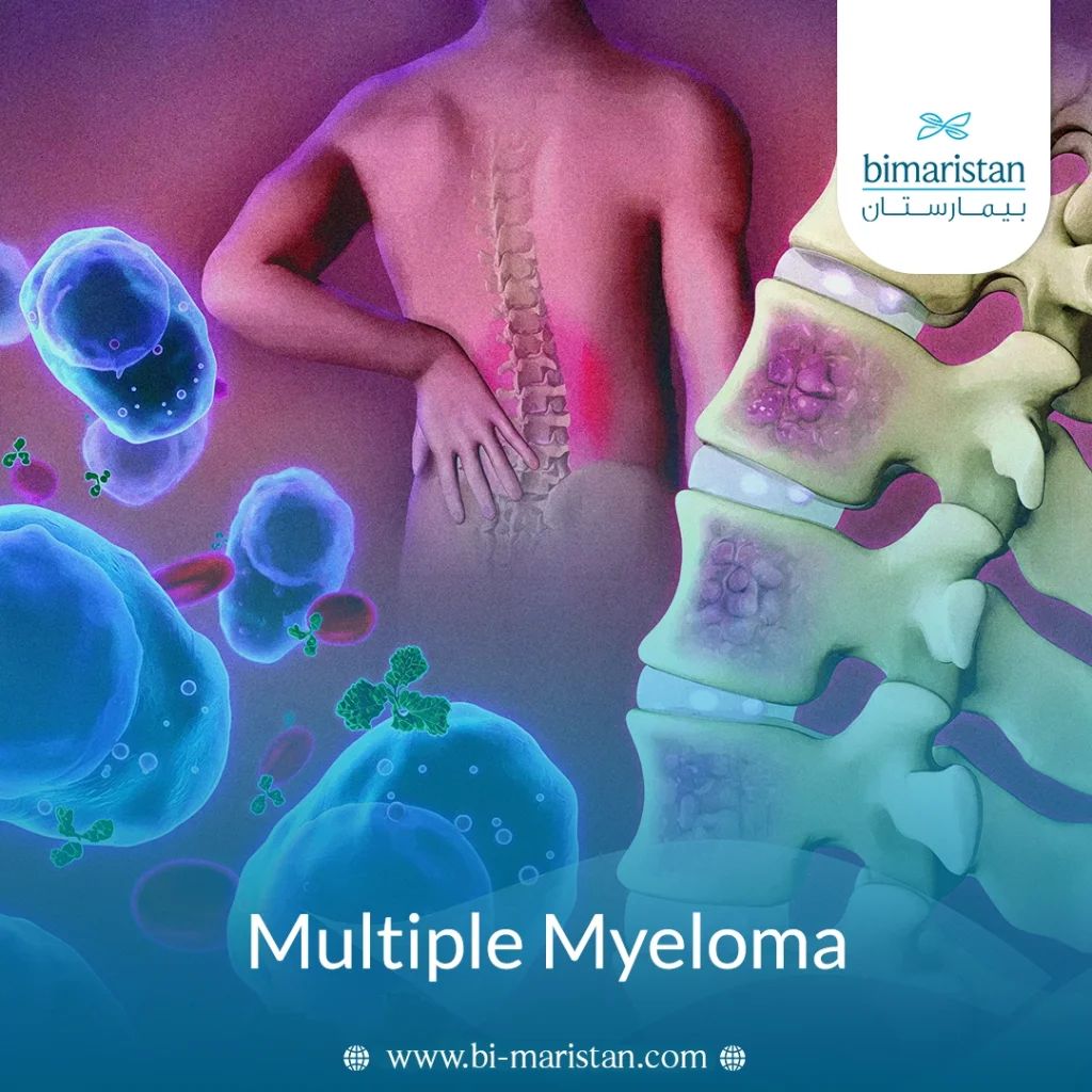 Multiple Myeloma
