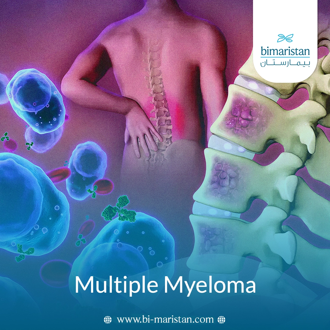 Multiple Myeloma