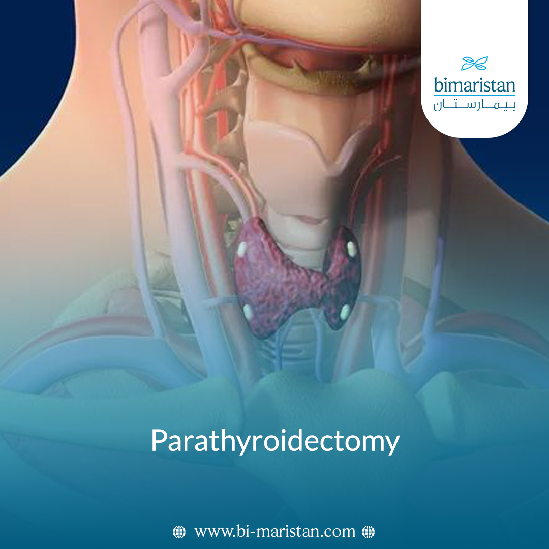Parathyroidectomy