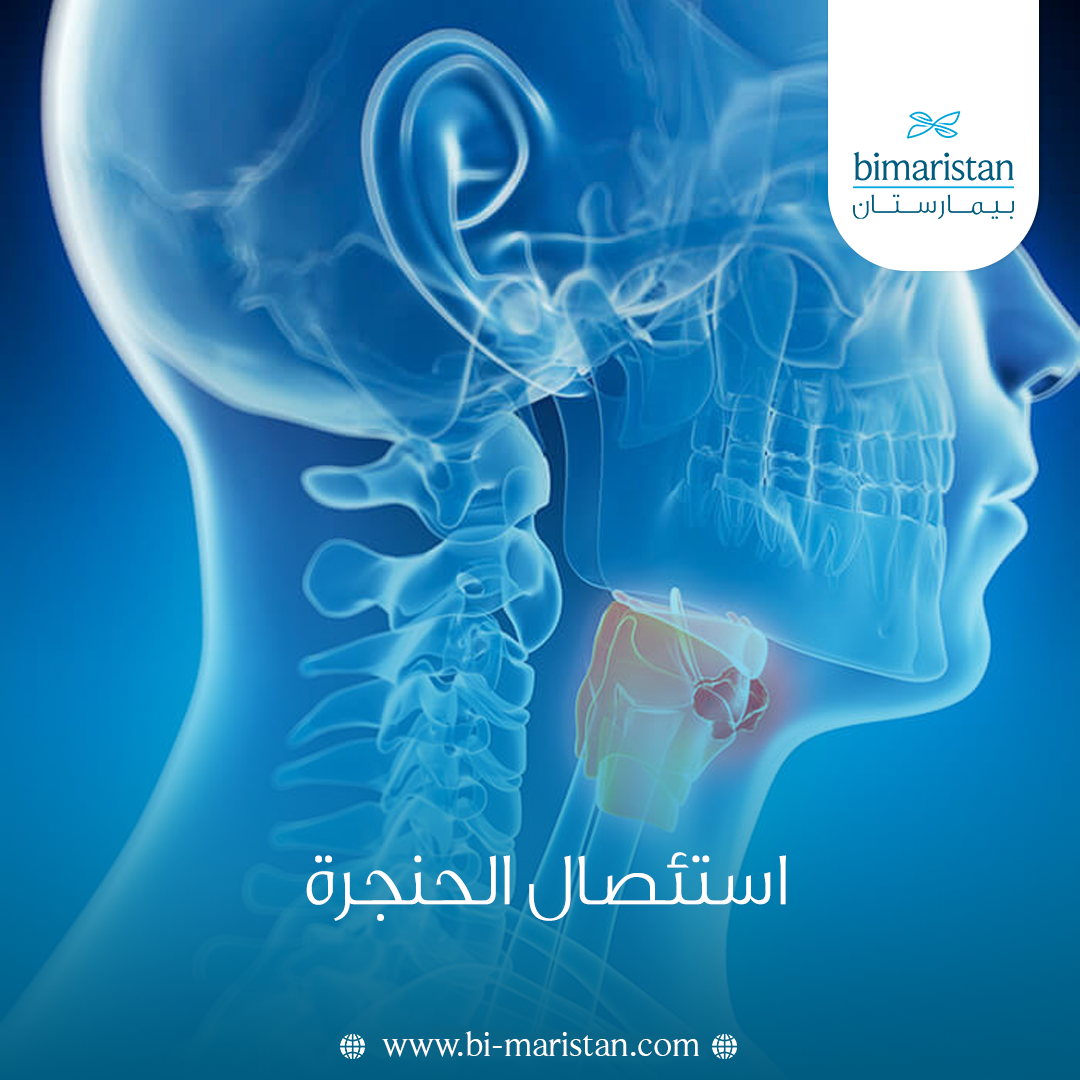 استئصال الحنجرة