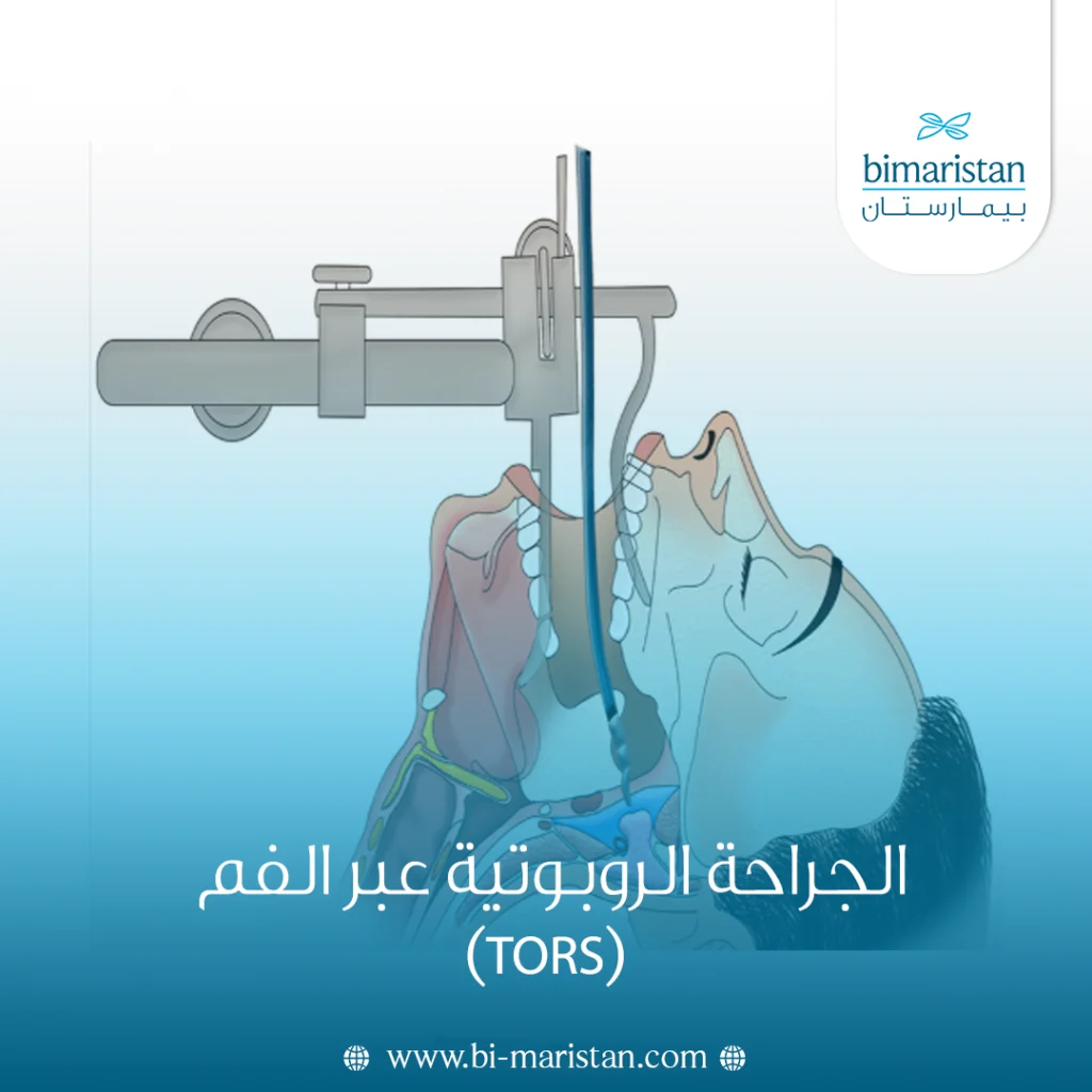 الجراحة الروبوتية عبر الفم (Tors): الاستخدامات والمميزات والمخاطر 2 الجراحة الروبوتية عبر الفم (Tors)