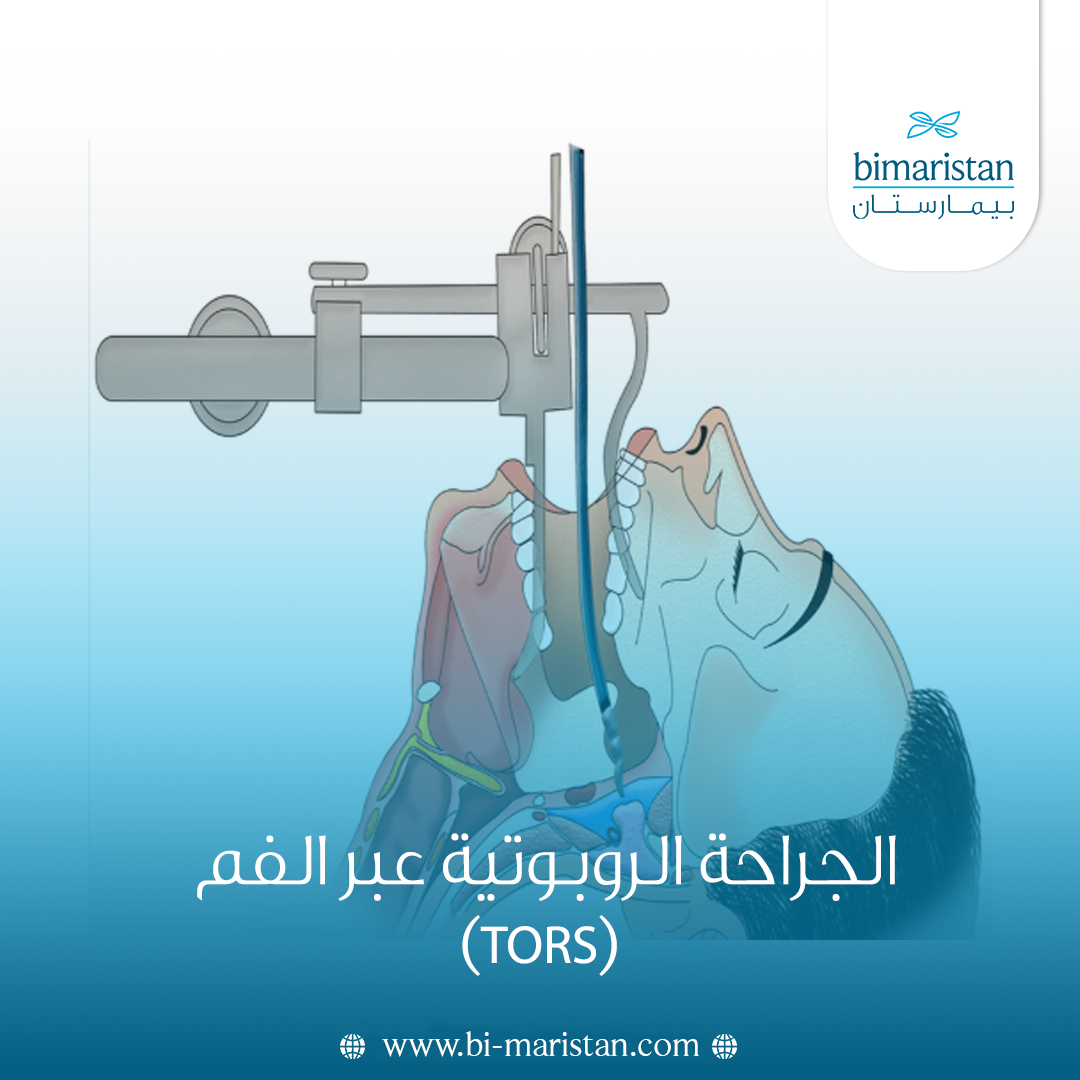 الجراحة الروبوتية عبر الفم (Tors)