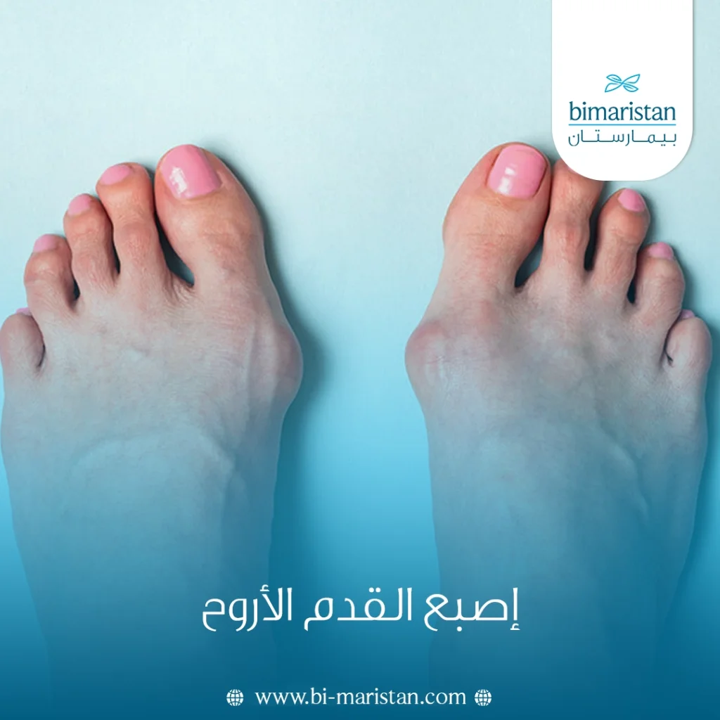 إصبع القدم الأروح