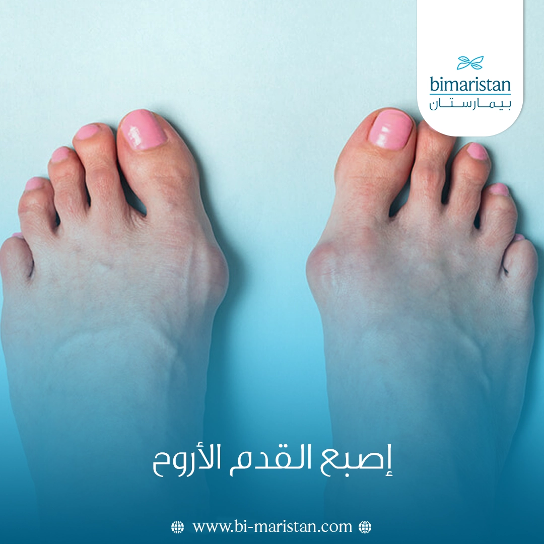 إصبع القدم الأروح