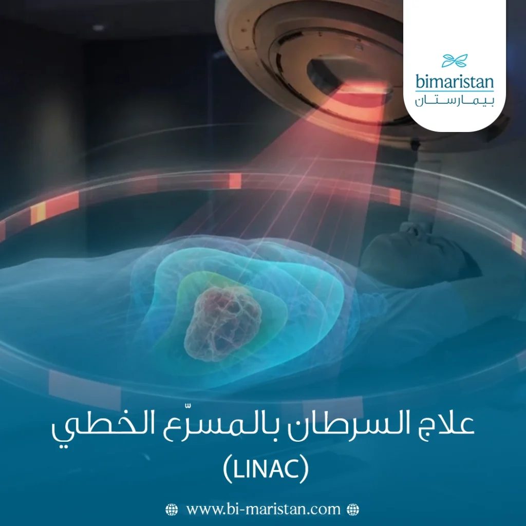 علاج السرطان بالمسرّع الخطي (Linac)