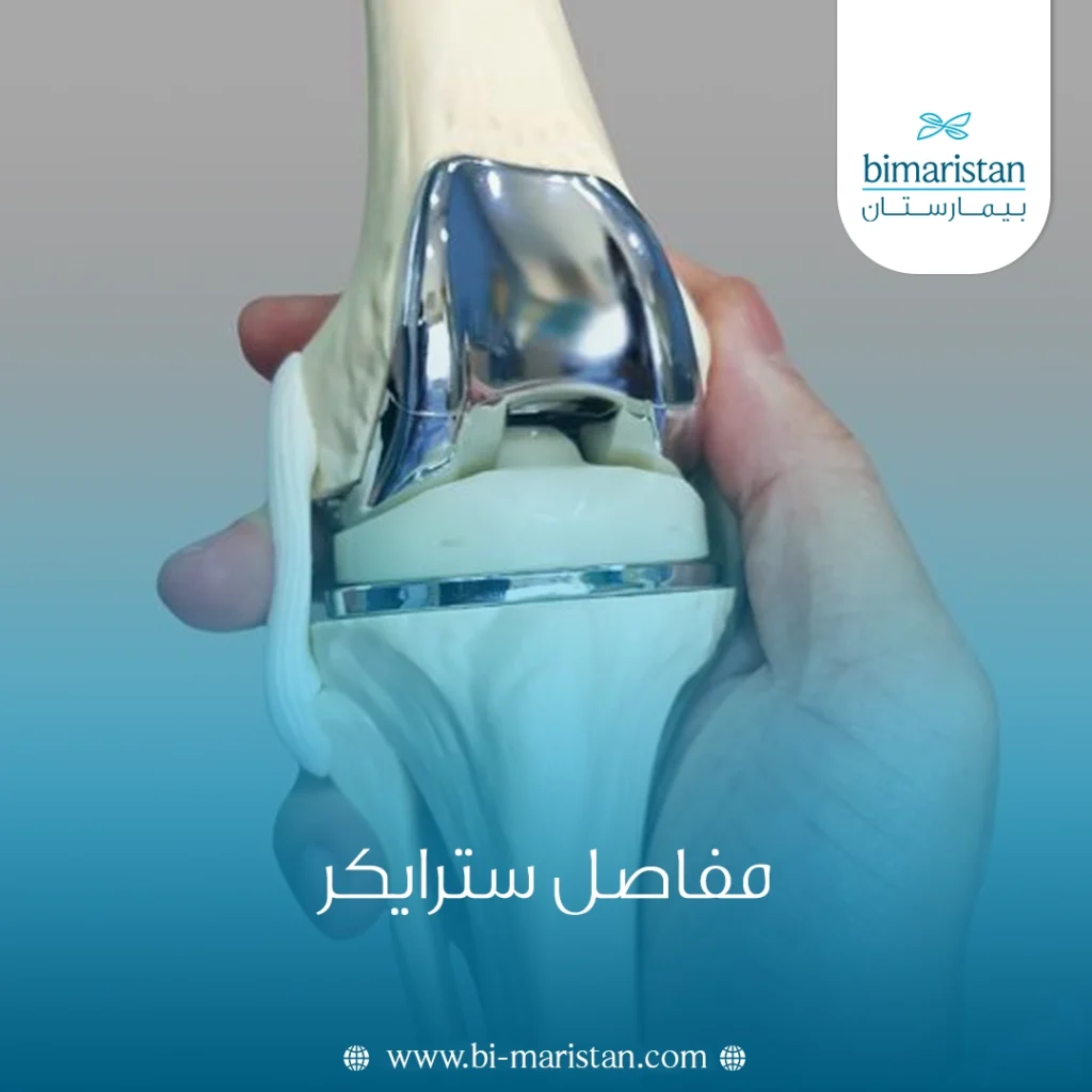 مفاصل سترايكر