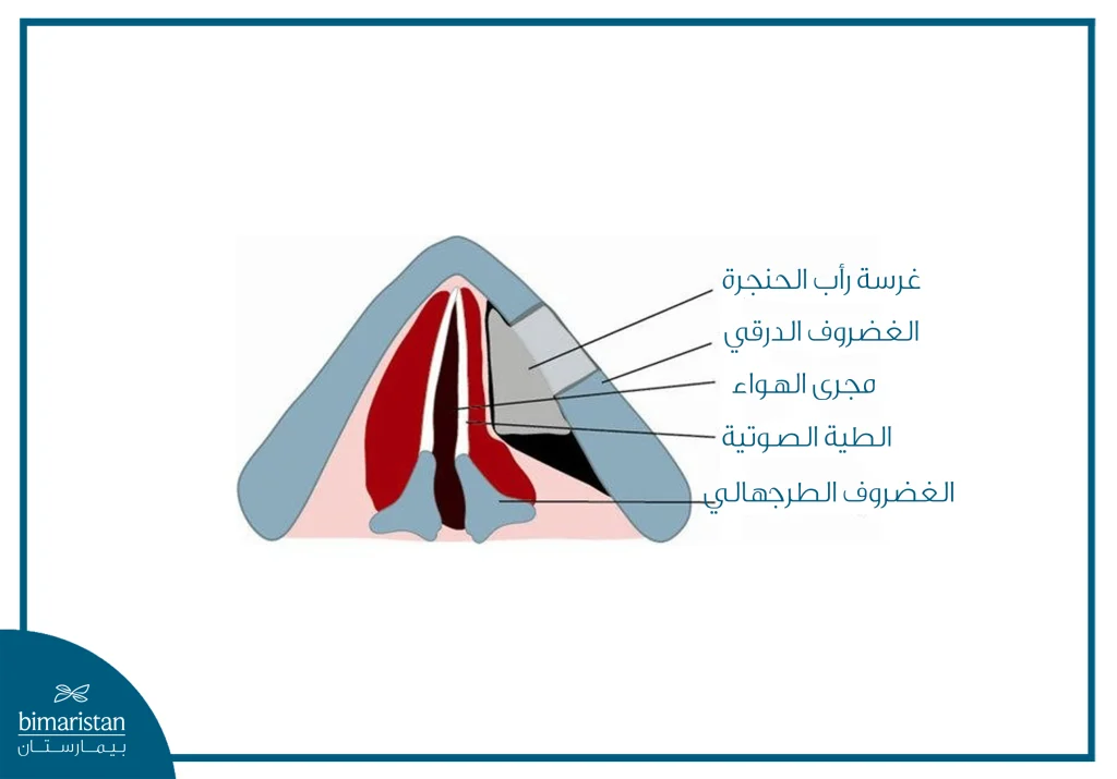 رأب الحنجرة بالتوسيط: الفوائد و المخاطر و تكاليف العلاج 2 رسم توضيحي يبين الحنجرة بعد إجراء رأب الحنجرة بالتوسيط.