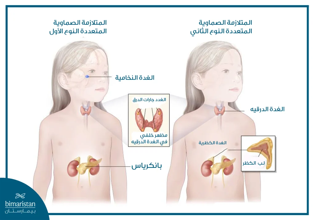 متلازمة الأورام الصماويّة المتعددة (Men): الأعراض، التشخيص، والعلاج 3 صورة توضح الغدد المصابة في كل من نوعي المتلازمة الصماوّية المتعدّدة