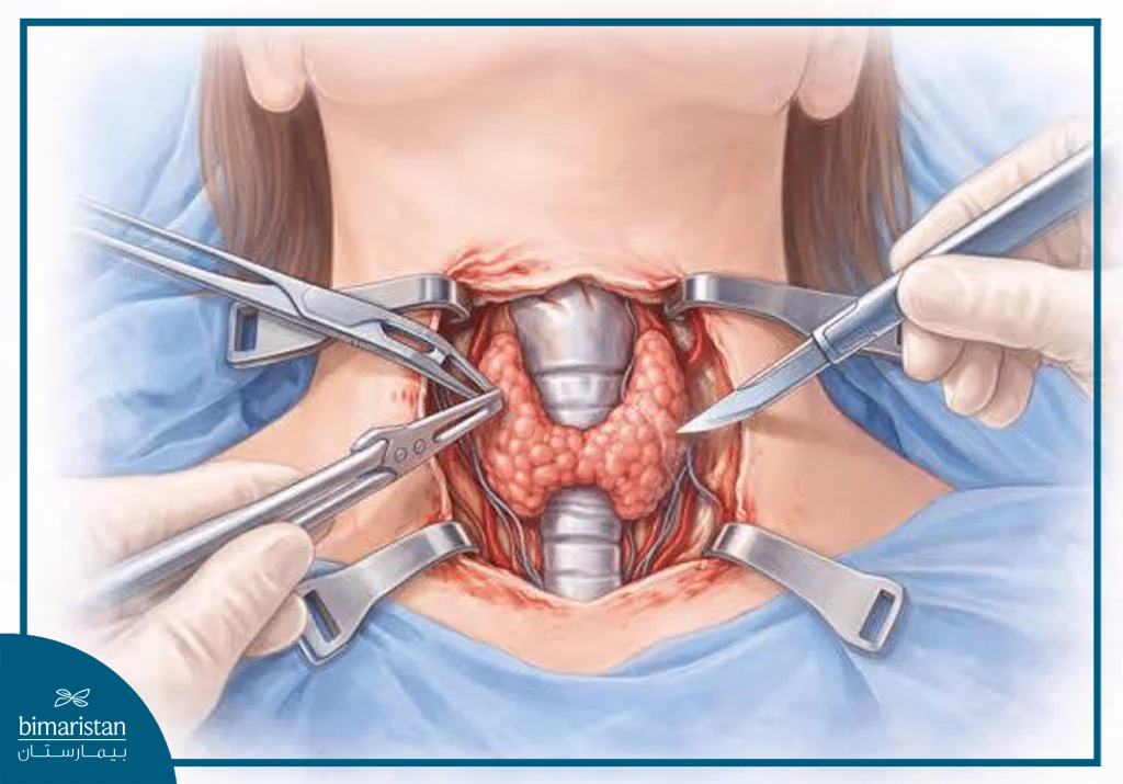 An Image Illustrating Thyroidectomy For Men Syndrome Treatment