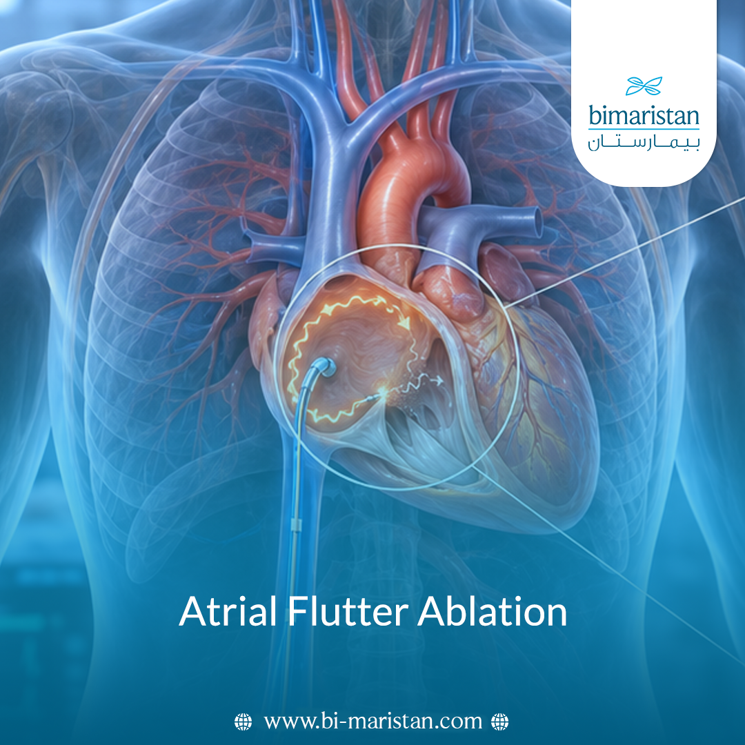Atrial Flutter Ablation