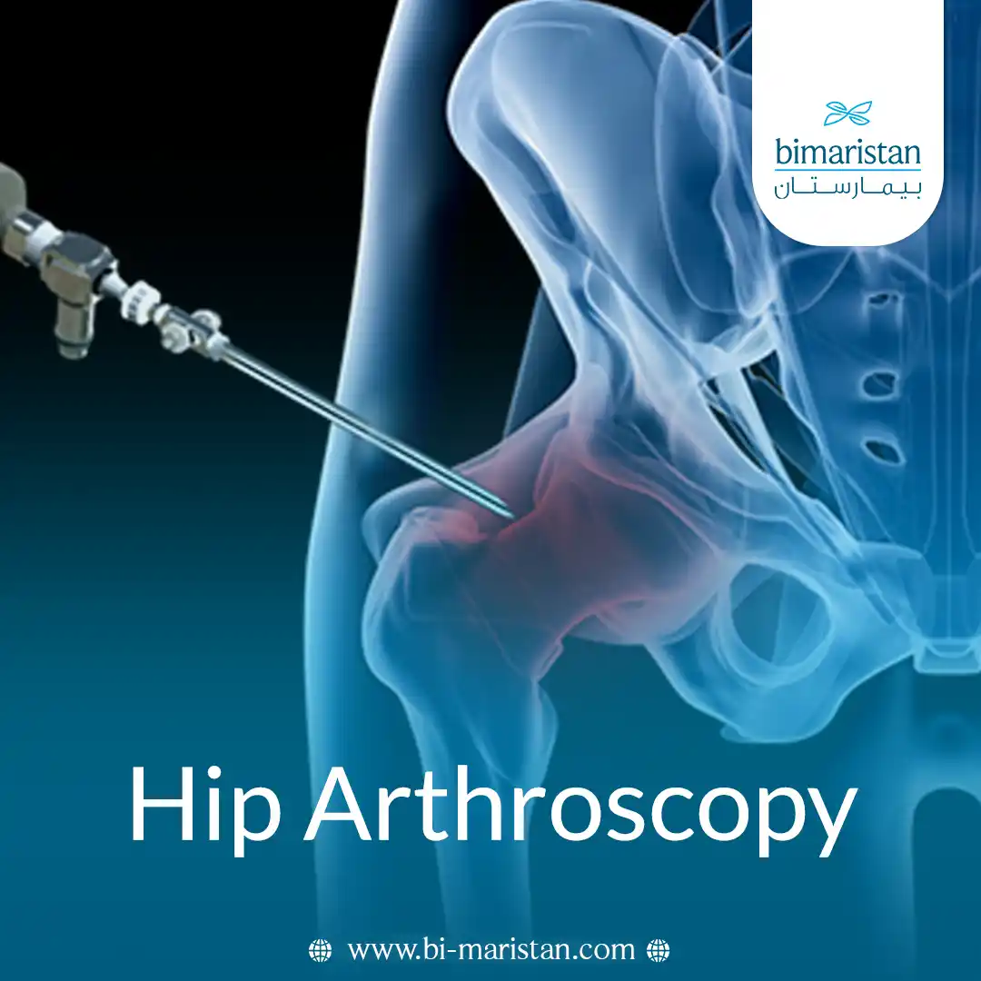 Hip Arthroscopy