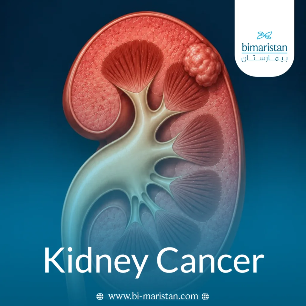 Kidney Cancer