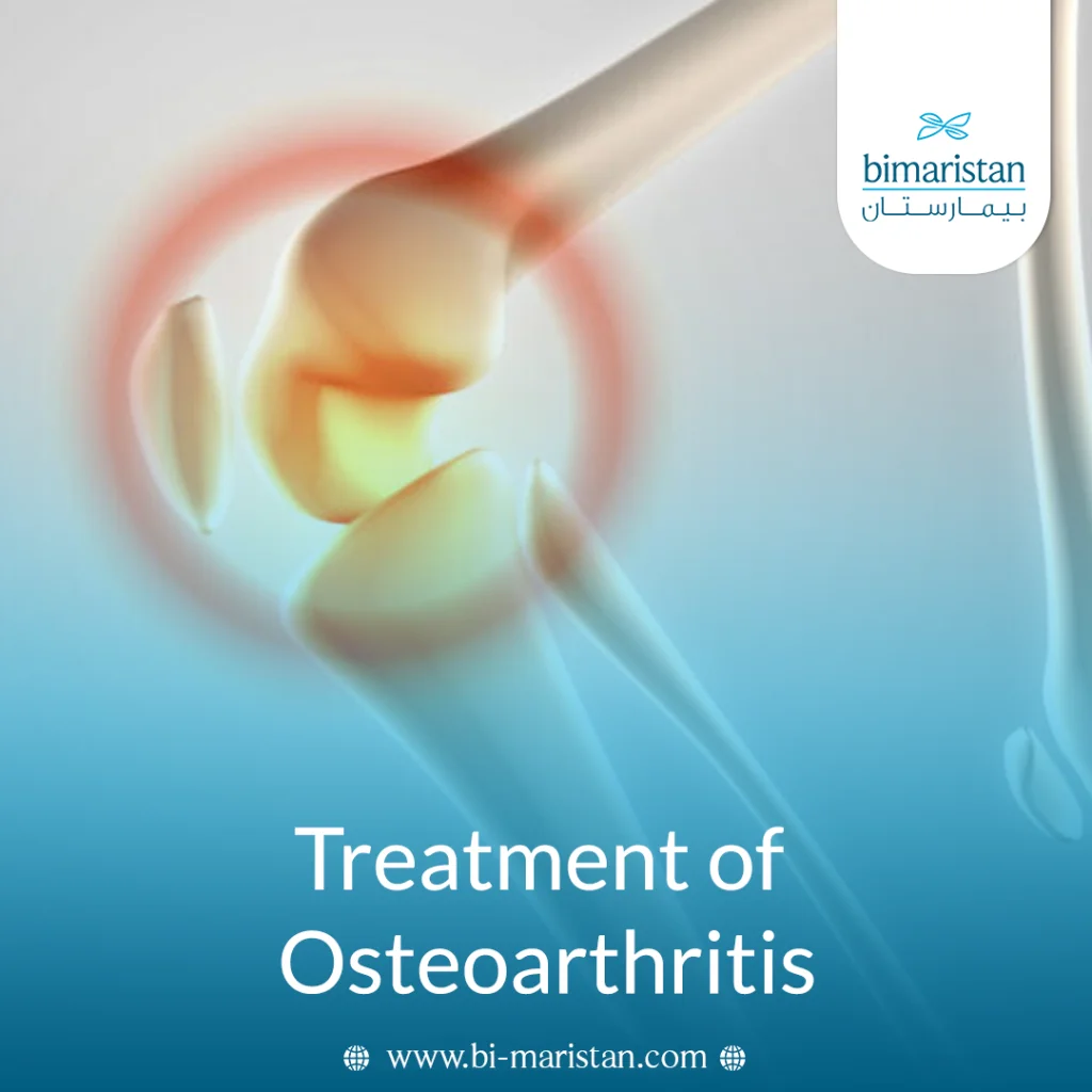 Treatment Of Osteoarthritis