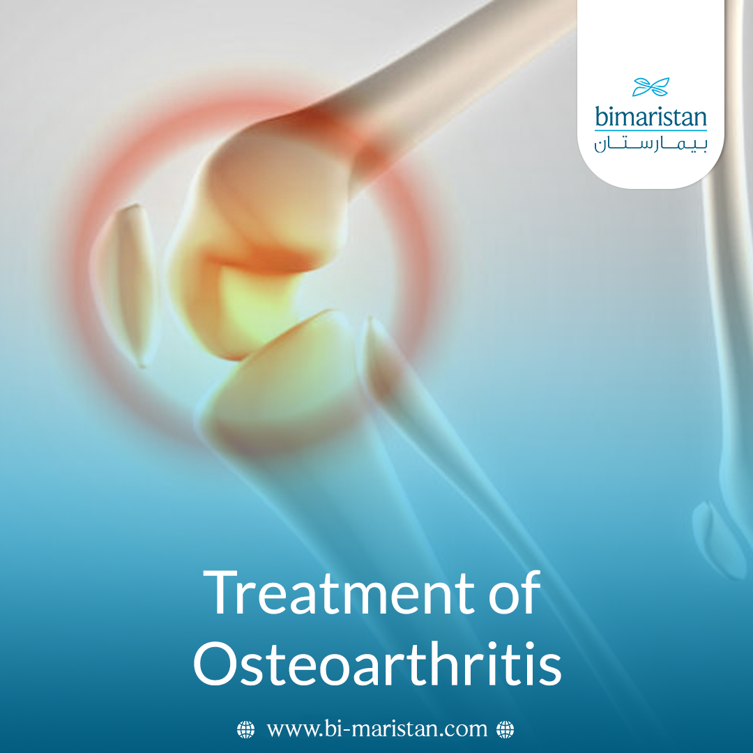 Treatment Of Osteoarthritis
